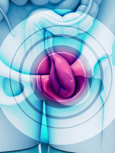 Día Mundial del Cáncer de Vejiga: El 98% de los casos son superables con una detección oportuna 33 unnamed