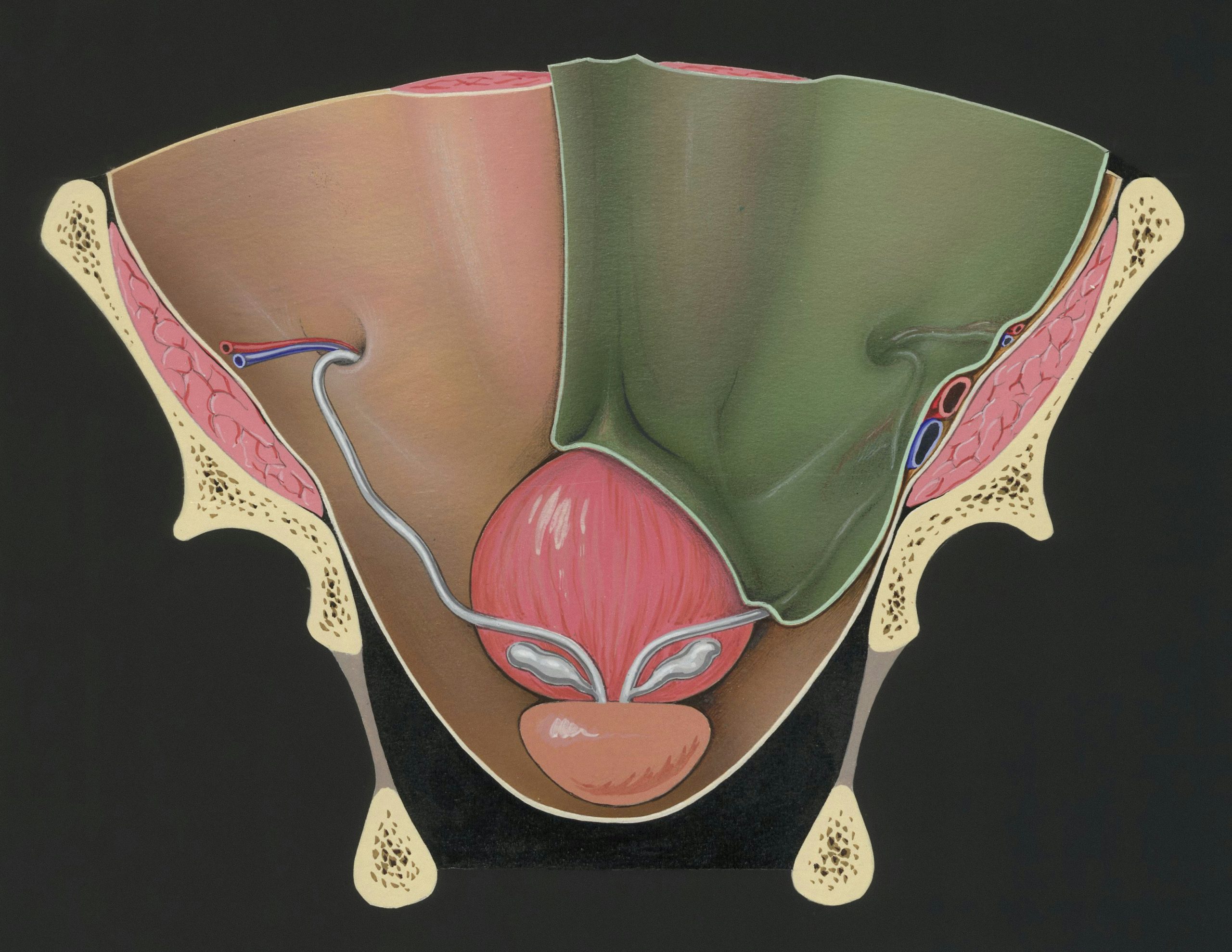 Avances en la cirugía ginecológica mínimamente invasiva: Especialista de Mayo Clinic expone alternativas de vanguardia para la endometriosis y los miomas uterinos 30 europeana 4ICUiwfGUrU unsplash scaled