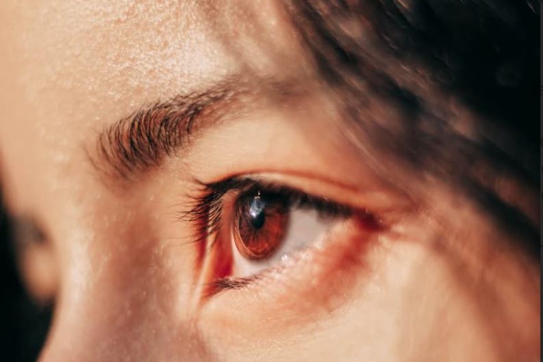 Alerta frente a las pantallas: ¿El ojo seco es una simple molestia o un riesgo real para tu vista? 31 image 5
